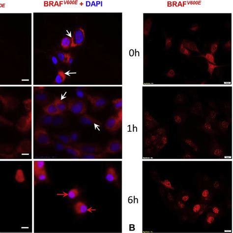 Nuclear localization of BRAF V600E in melanoma cells. SkMel-28 and ...