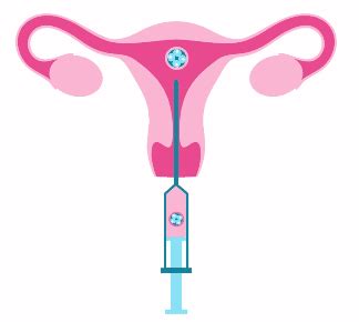 IVF clinic NYC and Brooklyn - In Vitro Fertilization Treatments Near Me