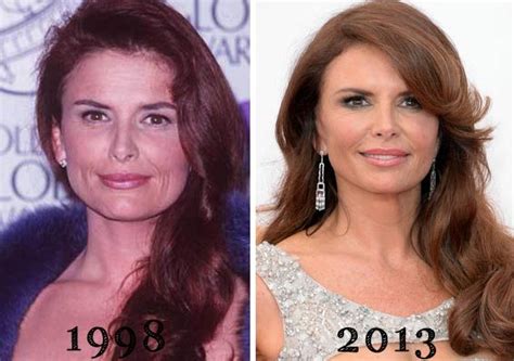 Roma Downey Plastic Surgery Before & After - Plastic Surgery Talks