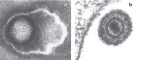 Human Cytomegalovirus (HCMV) Antigens - Creative Diagnostics