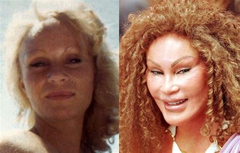 Jocelyn Wildenstein before and after plastic surgery (01) | Celebrity ...