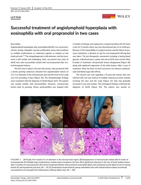 Successful treatment of Angiolymphoid Hyperplasia with Eosinophilia ...