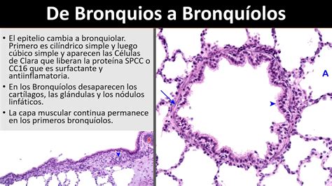 Bronquíolos - YouTube