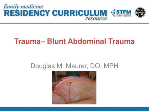 PPT - Trauma– Blunt Abdominal Trauma PowerPoint Presentation, free ...