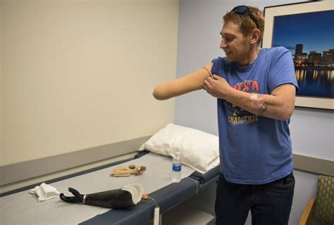 Vancouver man on road to recovery after getting new arm | The Columbian