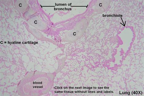 Bronchi and Bronchioles – Tutorial – Histology Atlas for Anatomy and Physiology