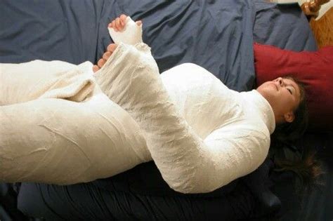 Pin by Medical on body cast | Body cast, Full body cast, Sports knee brace