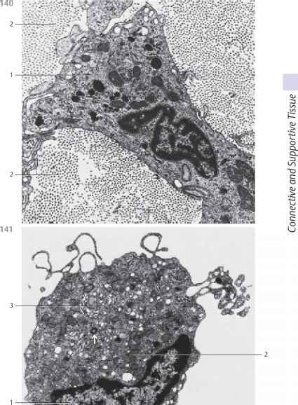 Free Connective Tissue Cells Macrophages - Electron Microscopy