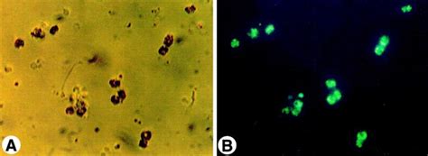 Identification of freshly isolated hepatic stellate cells (HSC).... | Download Scientific Diagram