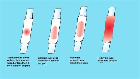 Heavy Implantation Bleeding Clots