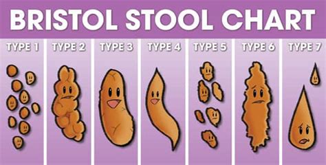 Bristol stool chart.