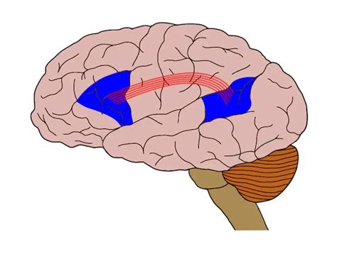 Know Your Brain: Aphasia