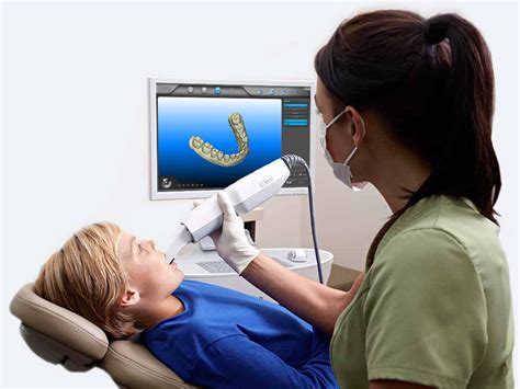 The iTero Digital Scan, Your First Step To A Customized Smile! | Masri ...