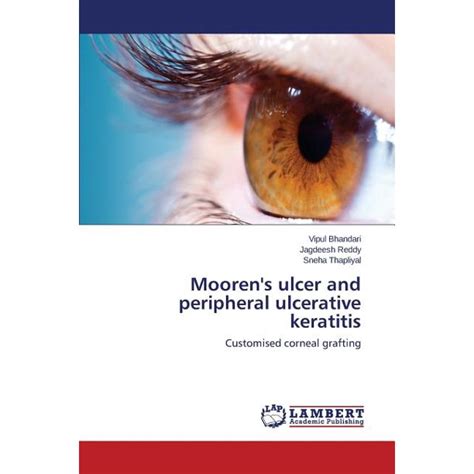 Mooren's Ulcer and Peripheral Ulcerative Keratitis - Walmart.com - Walmart.com