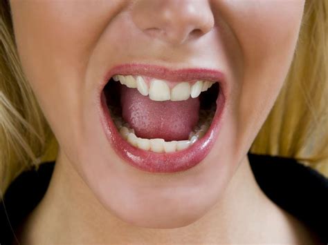 Burning tongue (burning mouth syndrome): Causes and home remedies