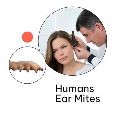 Human Ear Mites - Health, Beauty & Fitness Service In Zone P-ii Delhi - Click.in