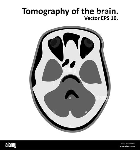 Cross section of the brain with magnetic resonance imaging. MRI / CT scan. Vector EPS10 Stock ...