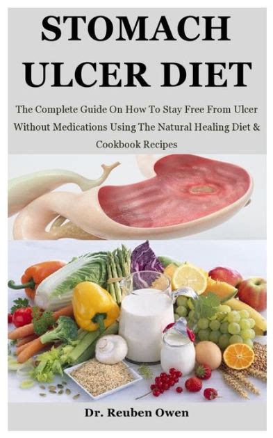 Stomach Ulcer Diet: The Complete Guide On How To Stay Free From Ulcer ...