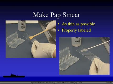 PPT - Pap Smear Technique PowerPoint Presentation, free download - ID ...