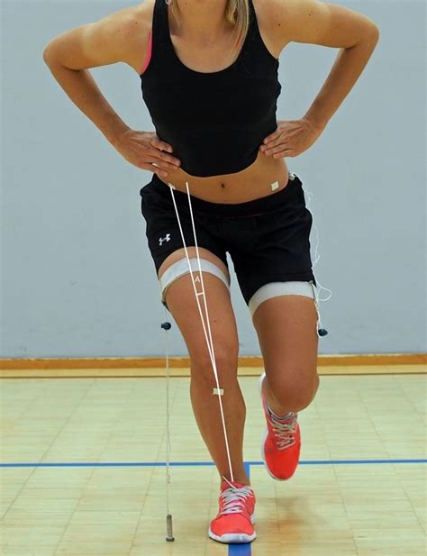 REDUCING ACL TEARS THROUGH SCREENING AND EXERCISE | ACE Physical Therapy and Sports Medicine ...