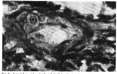 Figure 2 from The Apparatus in the Blood Vessels of the Hypophysis ...