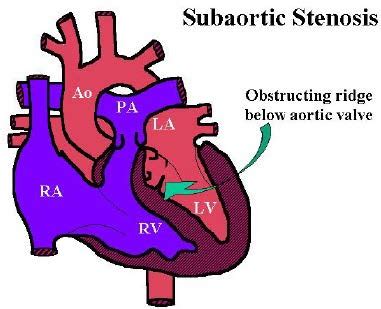 Dog Aortic Stenosis Symptoms and Treatment | Dog Health Guide