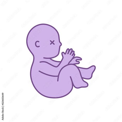 Dead fetus baby vector illustration. Concept miscarriage pregnancy ...