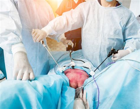 Process of Gynecological Surgery Operation Using Laparoscopic Equipment. Stock Photo - Image of ...