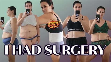 SURGERY UPDATE | breast reduction and panniculectomy | before & after - YouTube