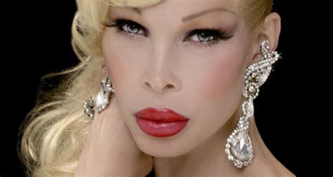 Chatter Busy: Amanda Lepore Plastic Surgery