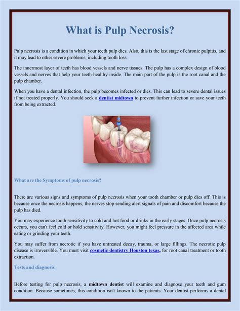 What is Pulp Necrosis? by The Dentist Houston - Issuu