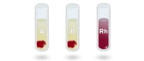 The Blood Typing Game - Tutorial 2: How do you get the blood type?