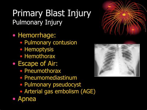 PPT - Evaluation and Treatment of Blast Injuries PowerPoint Presentation - ID:1223861