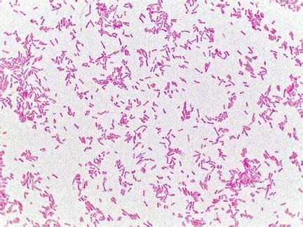 Biochemical expression of E. coli on agar and gram staining. (a) arrow... | Download Scientific ...