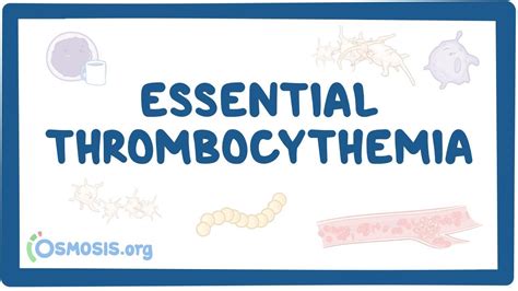 Essential thrombocythemia (NORD): Video & Anatomy | Osmosis