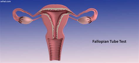 Fallopian Tube Test - Prep, Procedure, Results, Side Effects by Dr Somiruwani