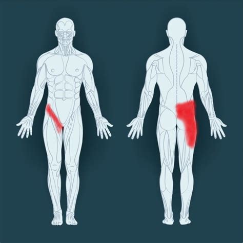 Common Groin Injuries - My Family Physio