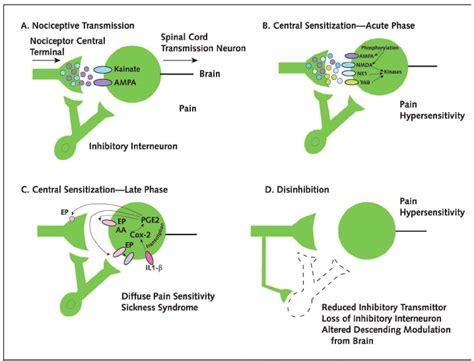 Contributions of spinal cord dorsal horn neurons to pain. | Download Scientific Diagram