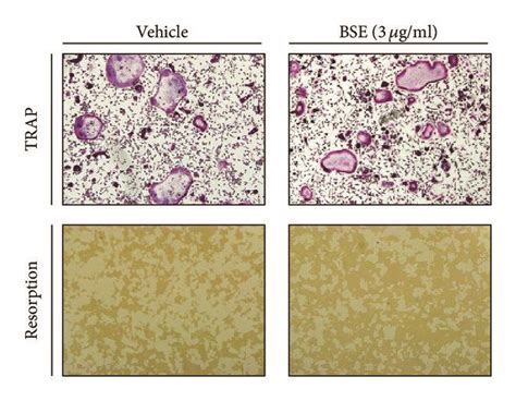 BSE impairs the osteoclastic function of giant multinucleated cells.... | Download Scientific ...