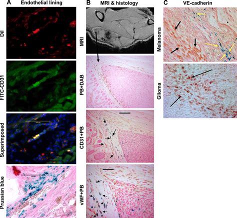 Immunohistochemistry showing endothelial markers in administered cells.... | Download Scientific ...