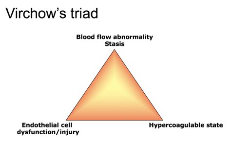 Virchow's triad | eClinpath