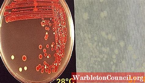 Serratia marcescens: characteristics, pathology and symptoms - science ...