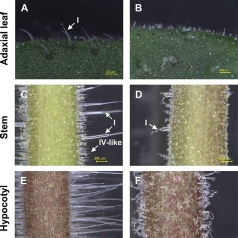 Light micrographs of trichomes on the leaf, stem, and hypocotyl of ...