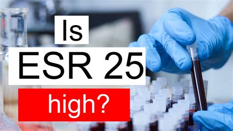 Is ESR 25 high, normal or dangerous? What does ESR level 25 mean?