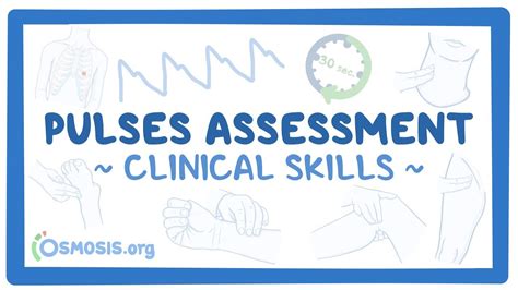 Clinical Skills: Pulses assessment - YouTube