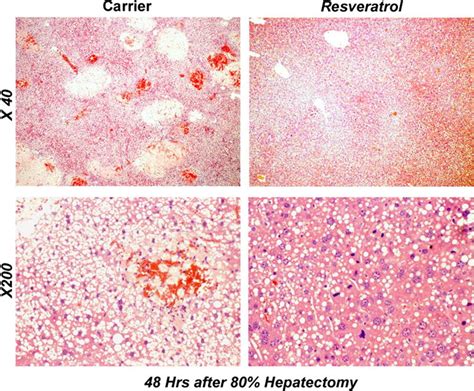 H&E sections demonstrating greatly reduced areas of hepatic necrosis,... | Download Scientific ...