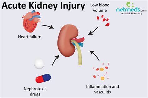 Acute Kidney Failure: Causes, Symptoms and Treatment