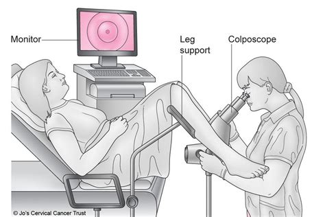 ABNORMAL PAP (CERVICAL SCREENING) TESTS