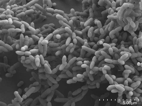 First overview of archaea in vertebrates