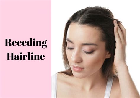 9 Different Types Of Hairlines | Low, Uneven, High, Receding and More!